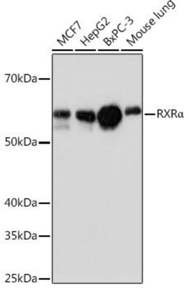 Anti-Retinoid X Receptor alpha/RXRA Antibody [ARC0468], 100 µl