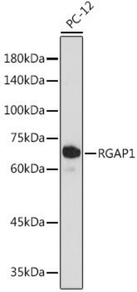Anti-RACGAP1/MGCRACGAP Antibody [ARC2394], 100 µl