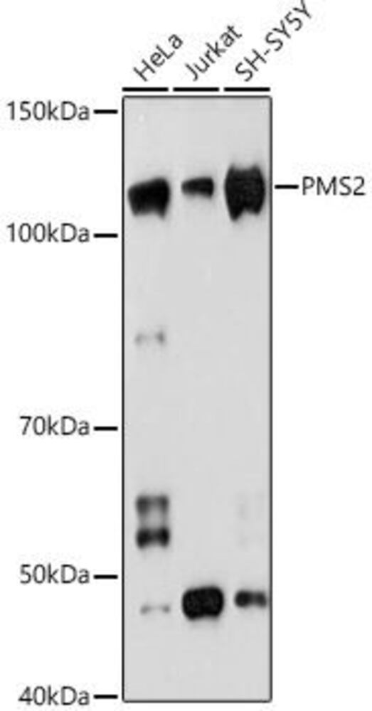 Anti-PMS2 Antibody [ARC1039]