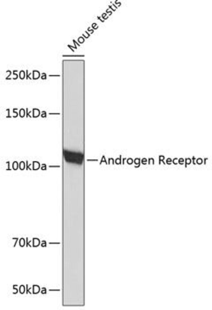 Anti-Androgen Receptor Antibody [ARC0090], 100 µl