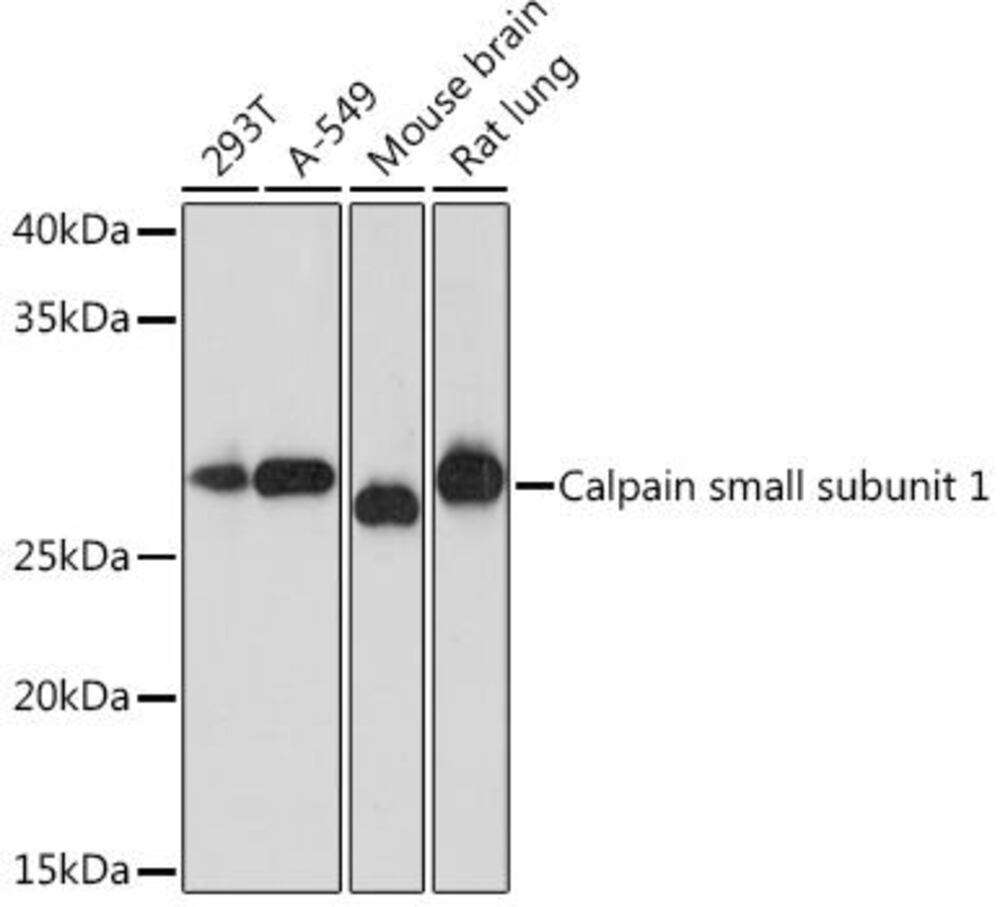 Anti-Calpain small subunit 1 Antibody [A, RC1326], 100 µl