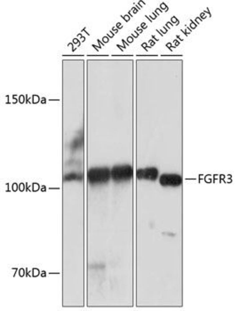 Anti-FGFR3 Antibody [ARC0398], 100 µl