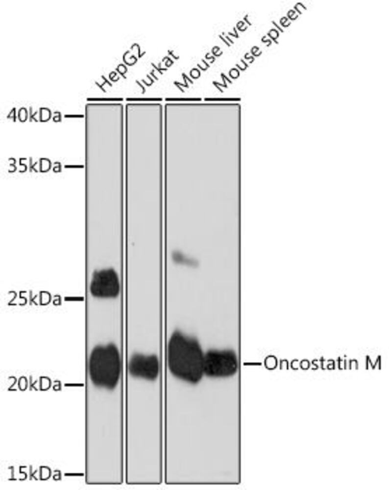 Anti-Oncostatin M/OSM Antibody [ARC1194], 100 µl