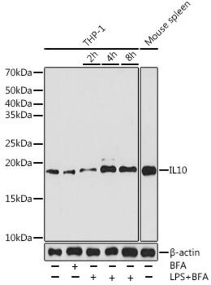 Anti-IL-10 Antibody [ARC0650], 100 µl