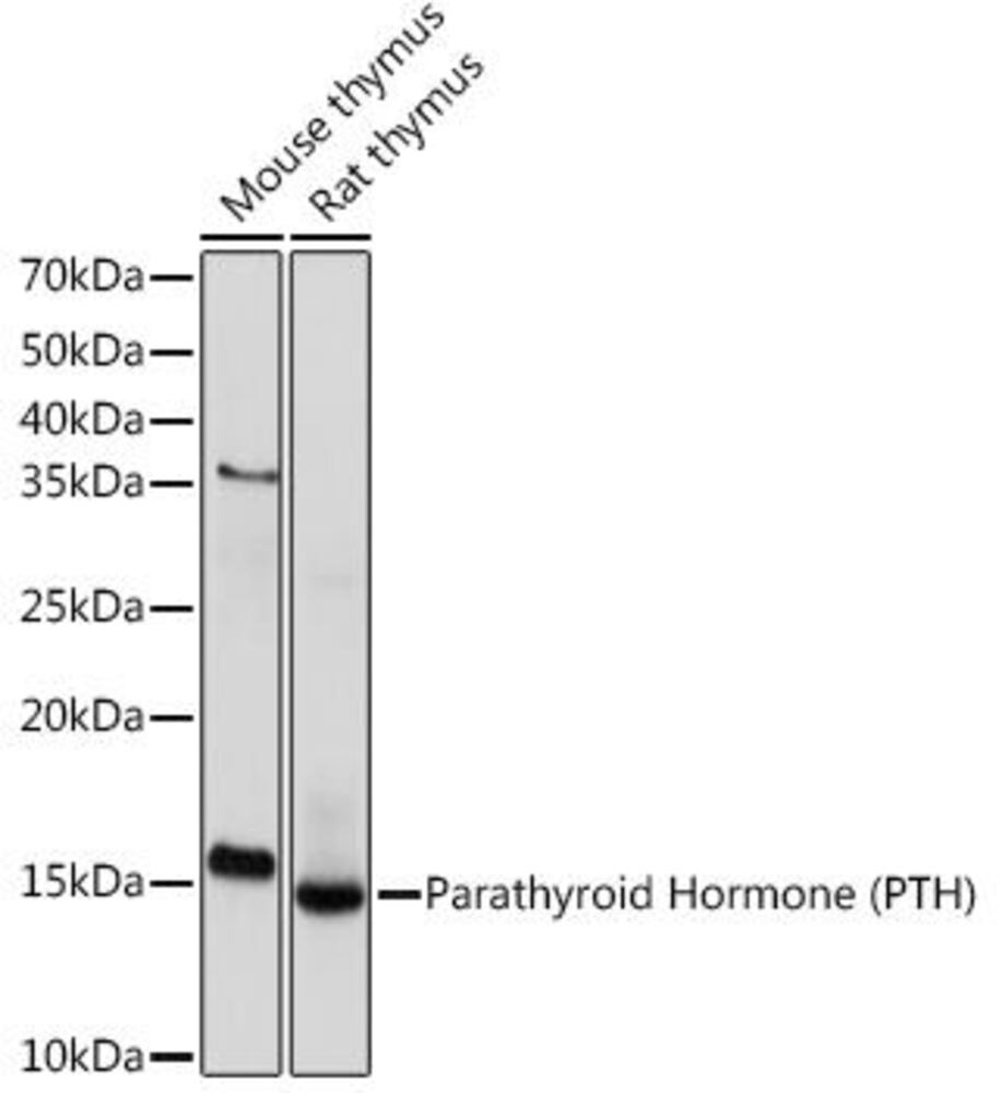 Anti-Parathyroid Hormone Antibody [ARC17, 09], 100 µl
