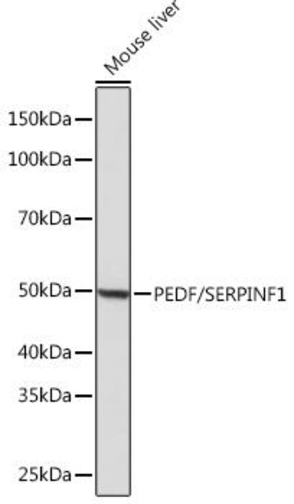 Anti-PEDF Antibody [ARC0784], 100 µl