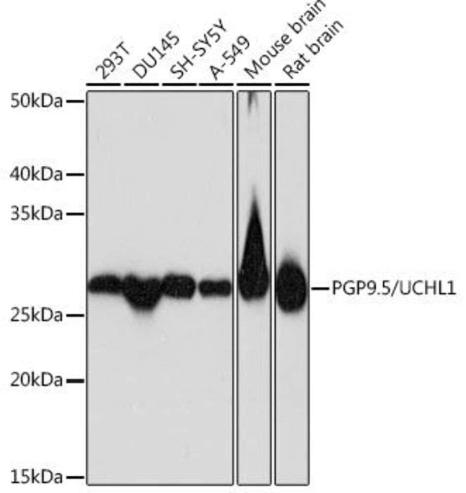 Anti-PGP9.5 Antibody [ARC50367], 100 µl