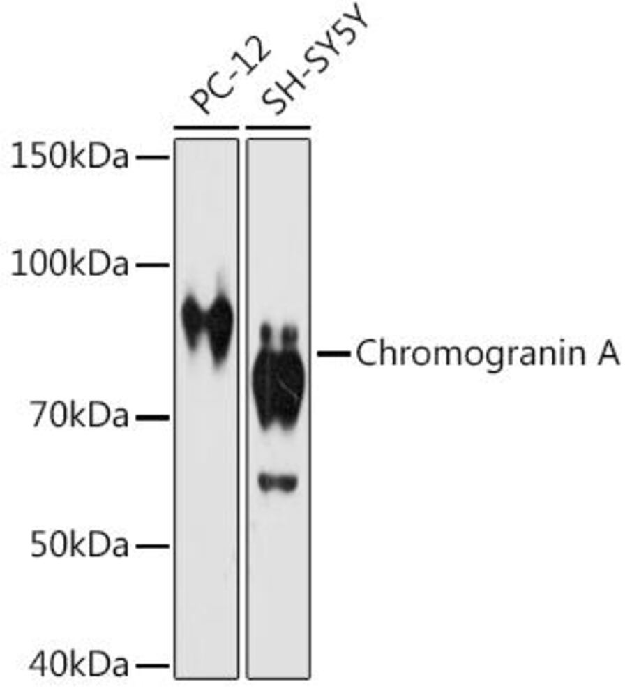 Anti-Chromogranin A Antibody [ARC1643]