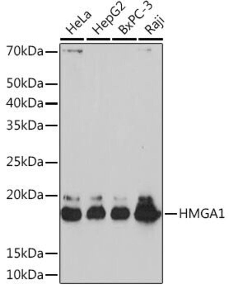 Anti-HMGA1 Antibody [ARC1060]