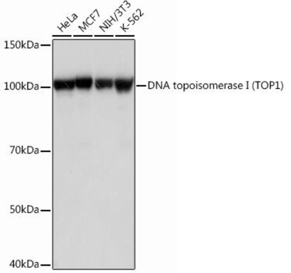 Anti-Topoisomerase I Antibody [ARC0708]