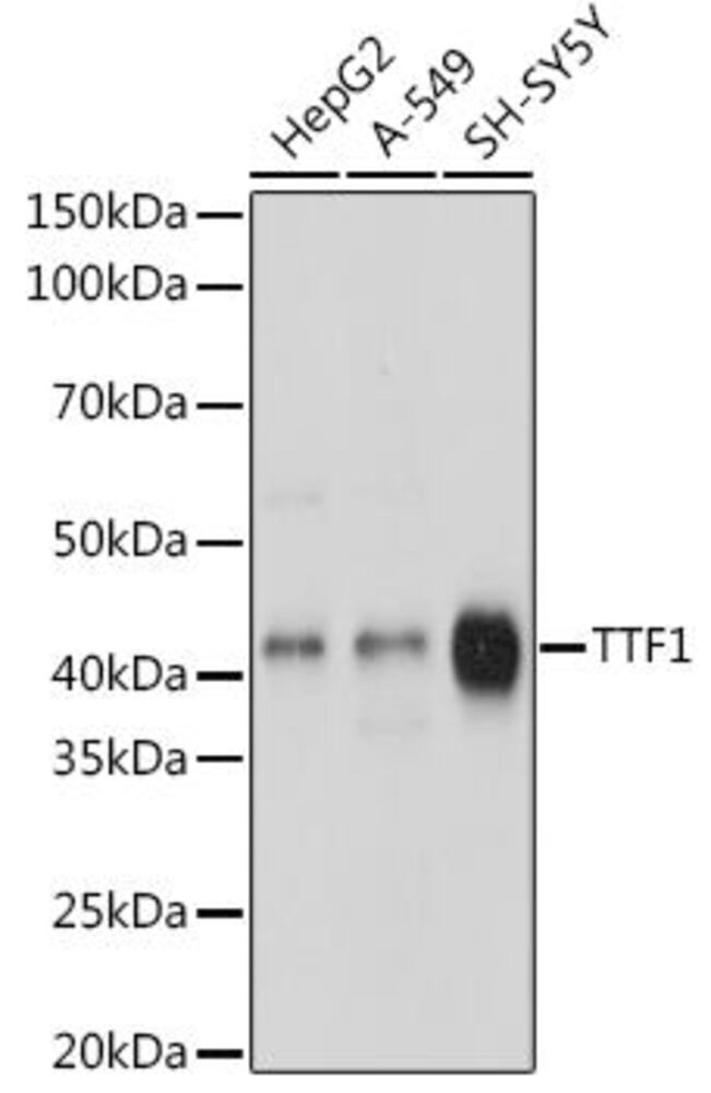 Anti-TTF1 Antibody [ARC1942]