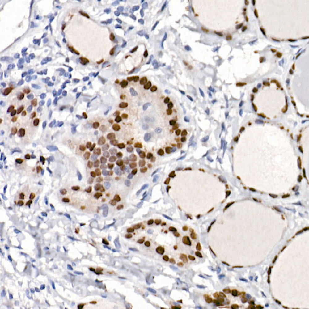 Anti-TTF1 Antibody [ARC2744]
