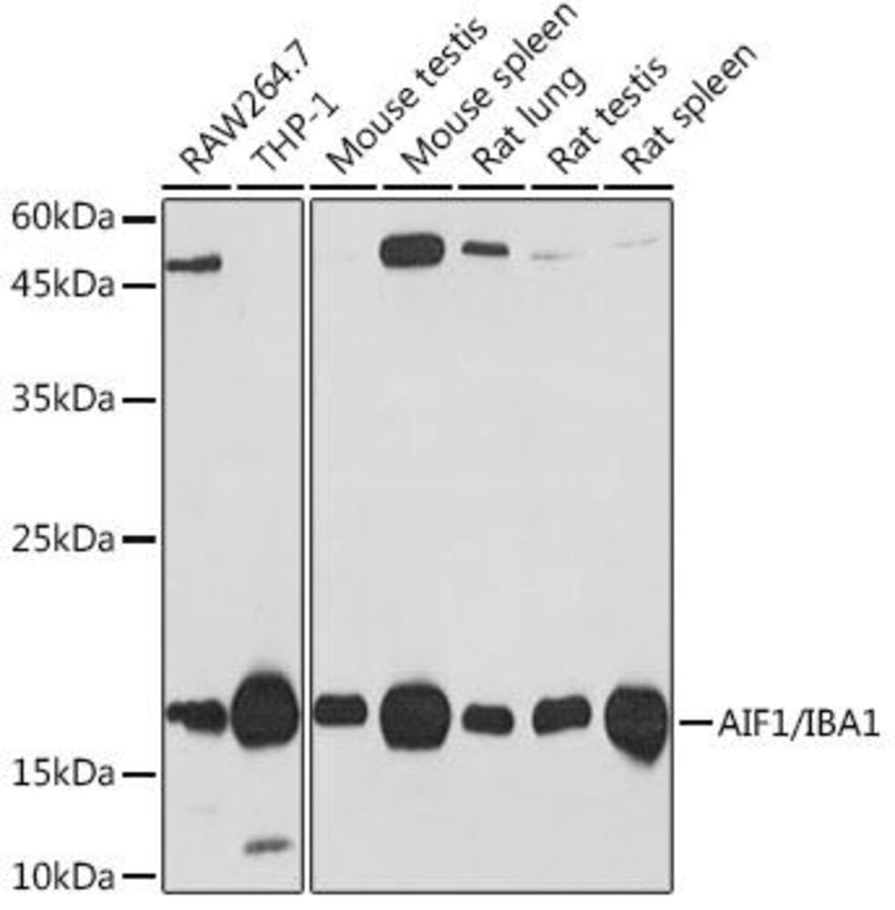 Anti-Iba1 Antibody [ARC2301], 100 µl