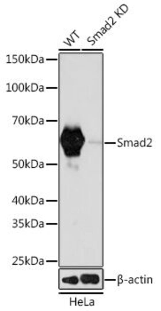 Anti-Smad2 Antibody [ARC0343]