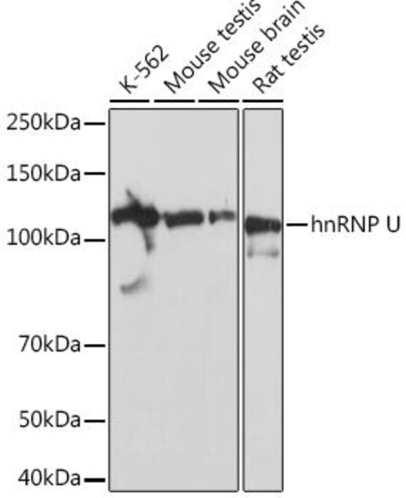 Anti-hnRNP U/p120 Antibody [ARC0942], 100 µl