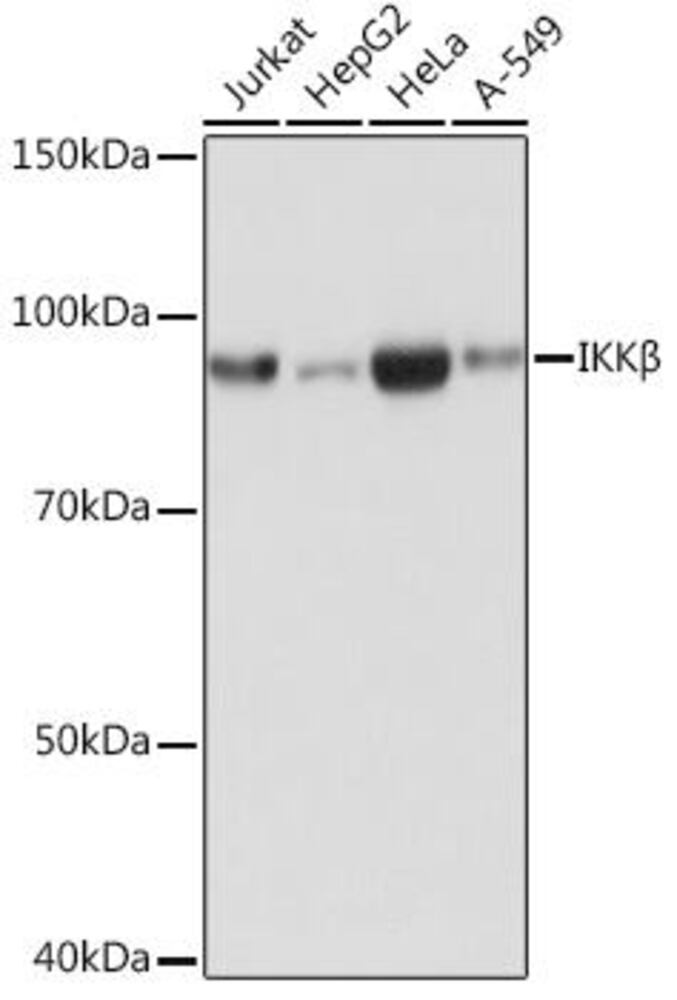Anti-IKK beta Antibody [ARC0085], 100 µl