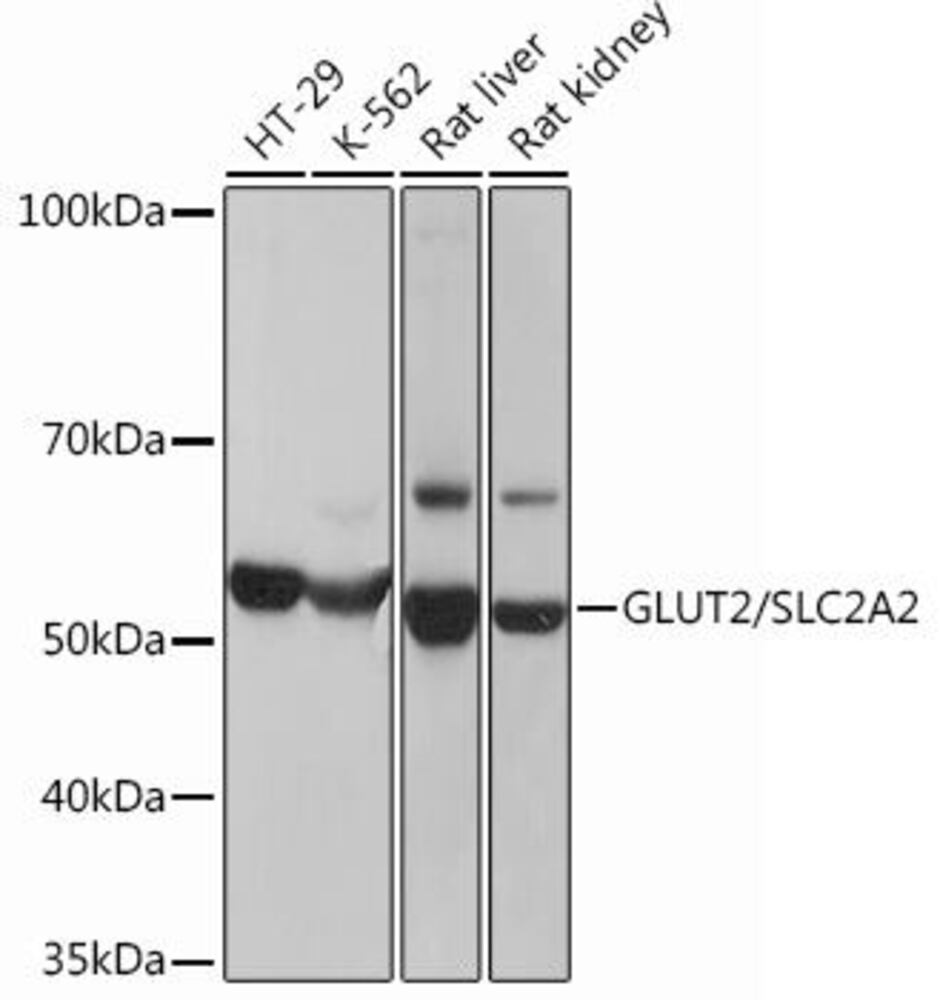 Anti-Glucose Transporter GLUT2 Antibody [ARC0305], 100 µl