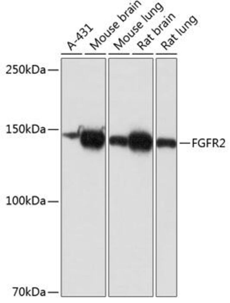 Anti-FGFR2 Antibody [ARC0480]
