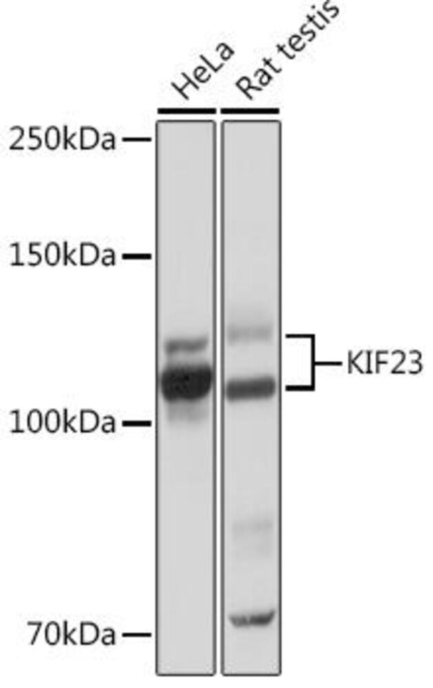 Anti-MKLP1 Antibody [ARC0335], 100 µl