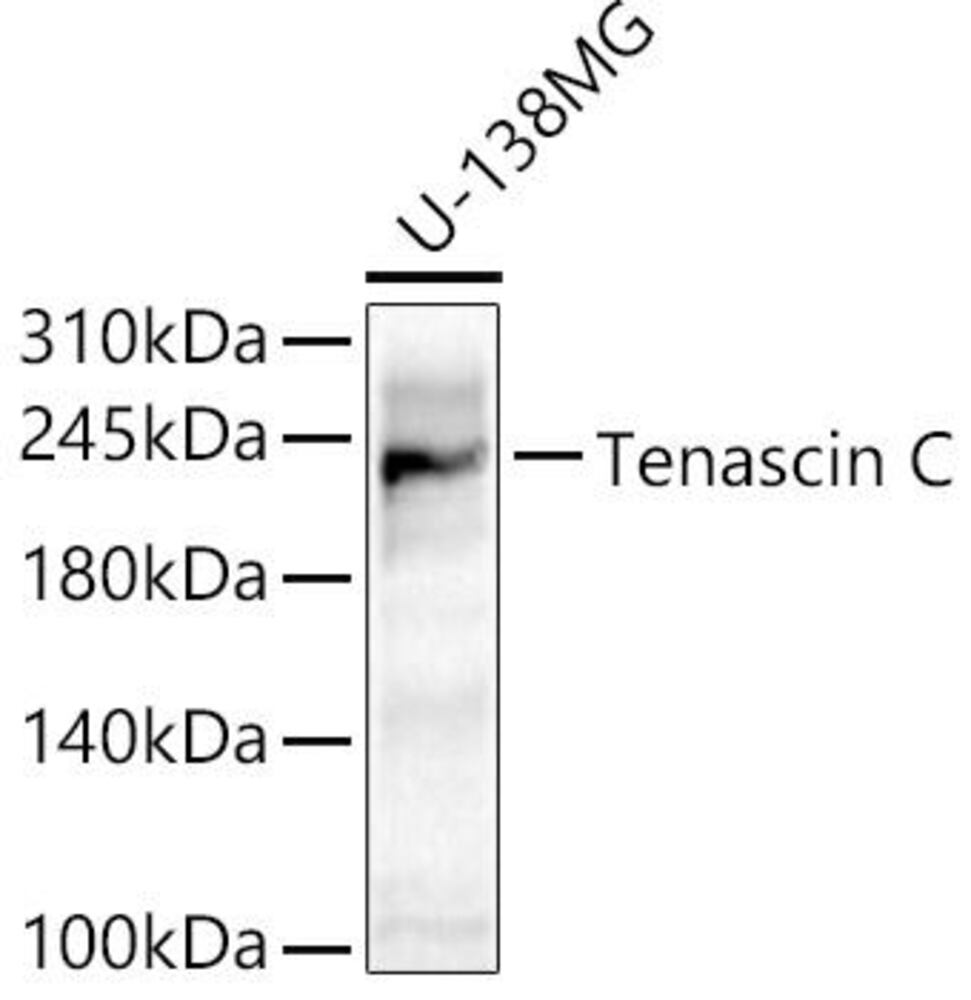 Anti-Tenascin C Antibody