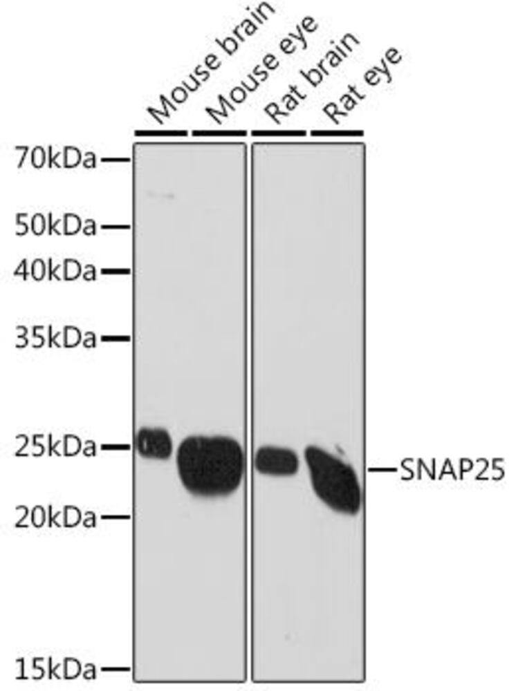 Anti-SNAP25 Antibody [ARC0736]