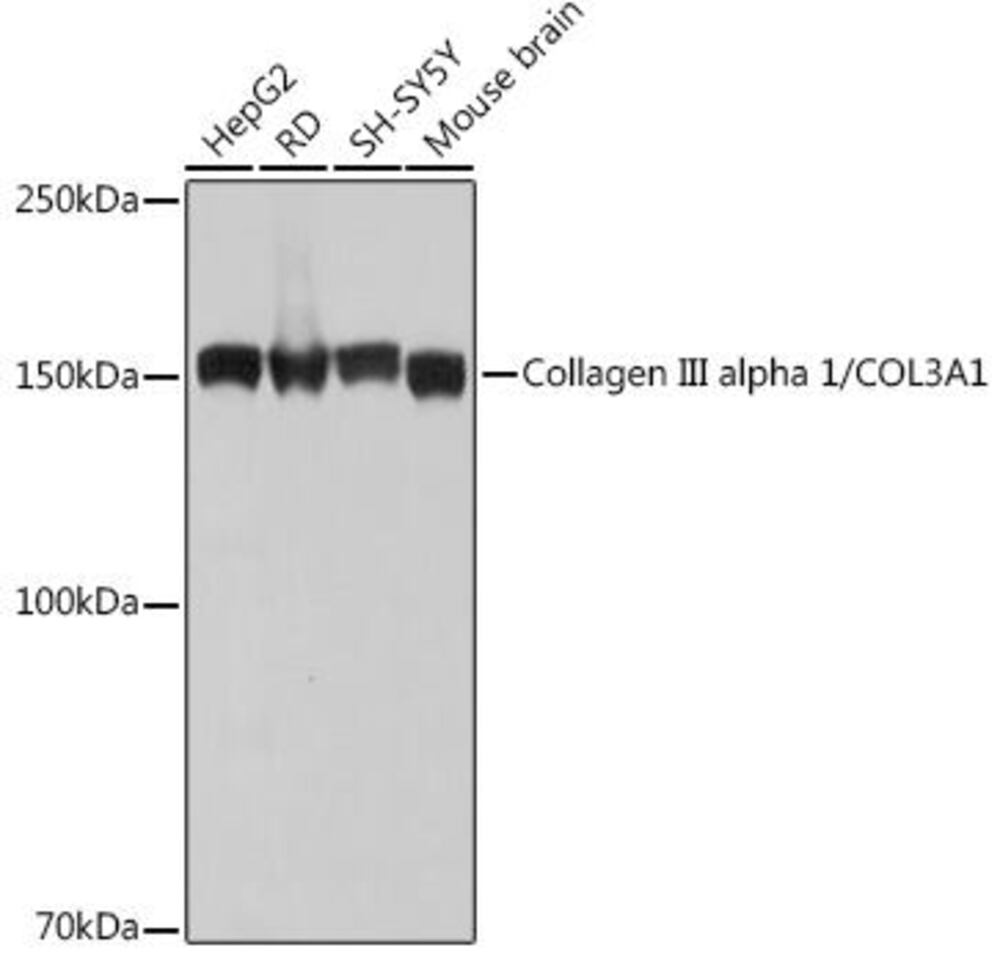 Anti-Collagen III Antibody [ARC2542]