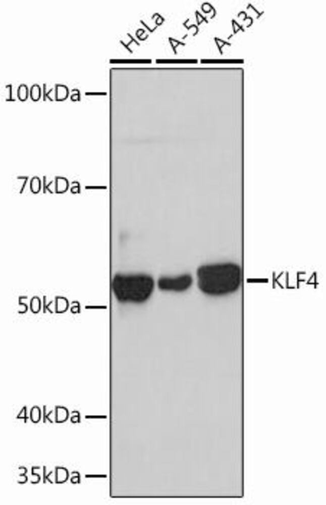 Anti-KLF4 Antibody [ARC0721]