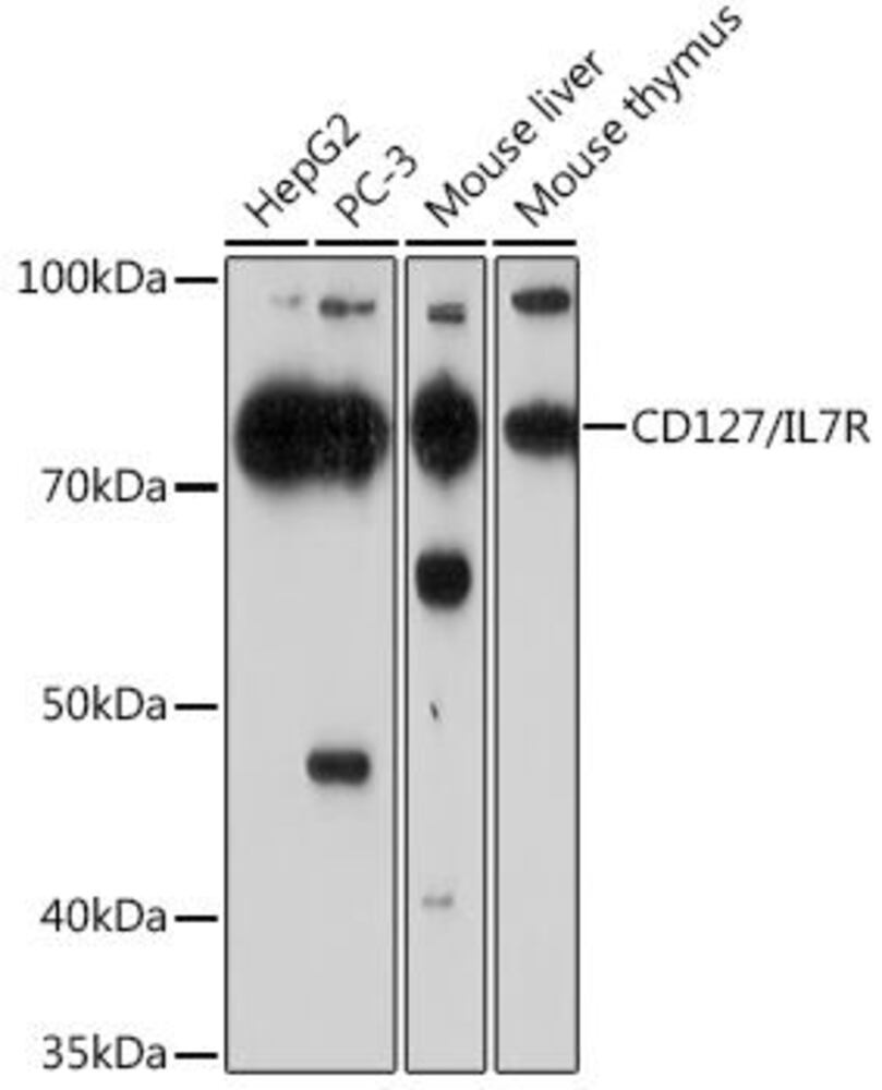 Anti-CD127 Antibody [ARC0672]
