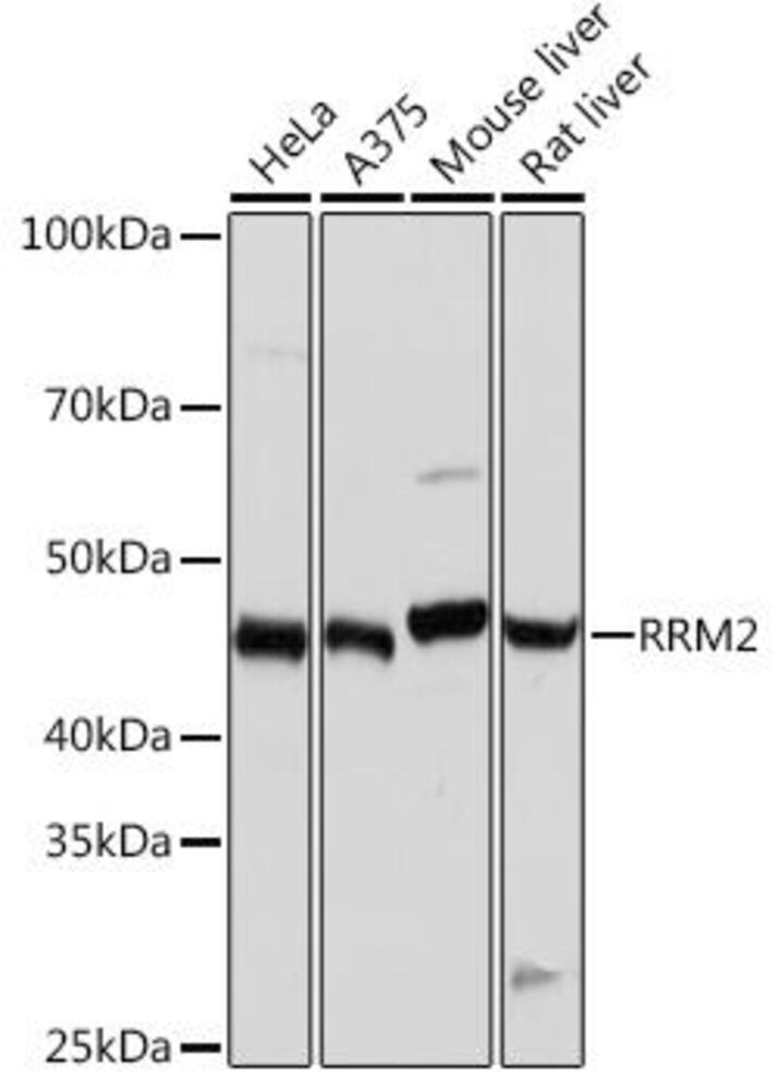 Anti-RRM2 Antibody [ARC0775]