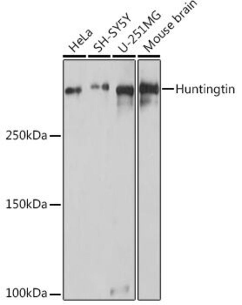Anti-Huntingtin Antibody