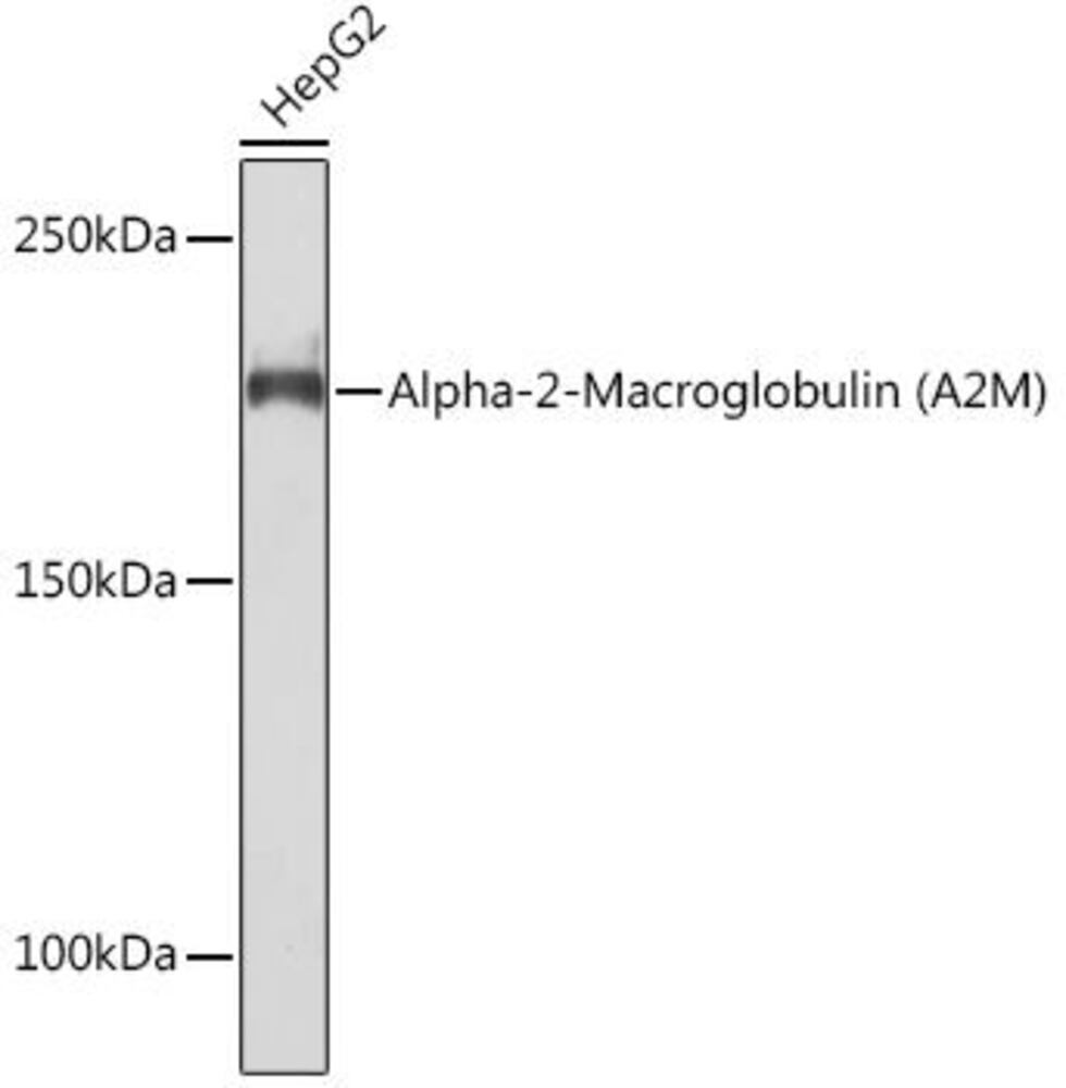 Anti-alpha 2 Macroglobulin Antibody [ARC1734]