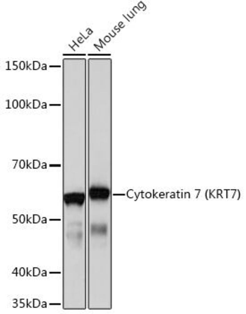 Anti-Cytokeratin 7 Antibody [ARC0978]