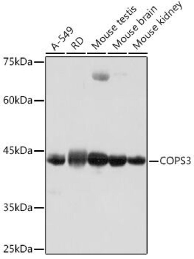 Anti-COPS3/CSN3 Antibody [ARC2182]