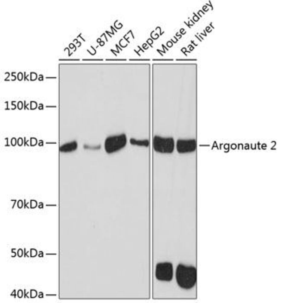 Anti-Argonaute-2 Antibody [ARC0189], 100 µl