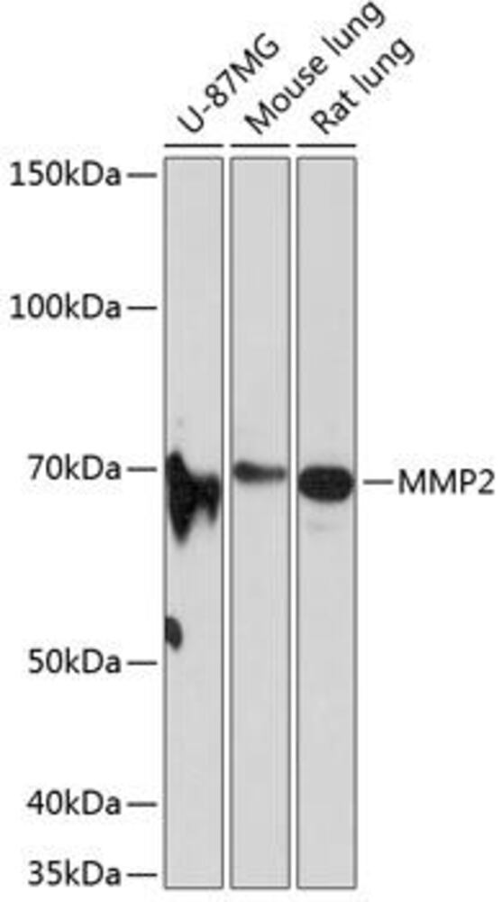 Anti-MMP2 Antibody [ARC0432]