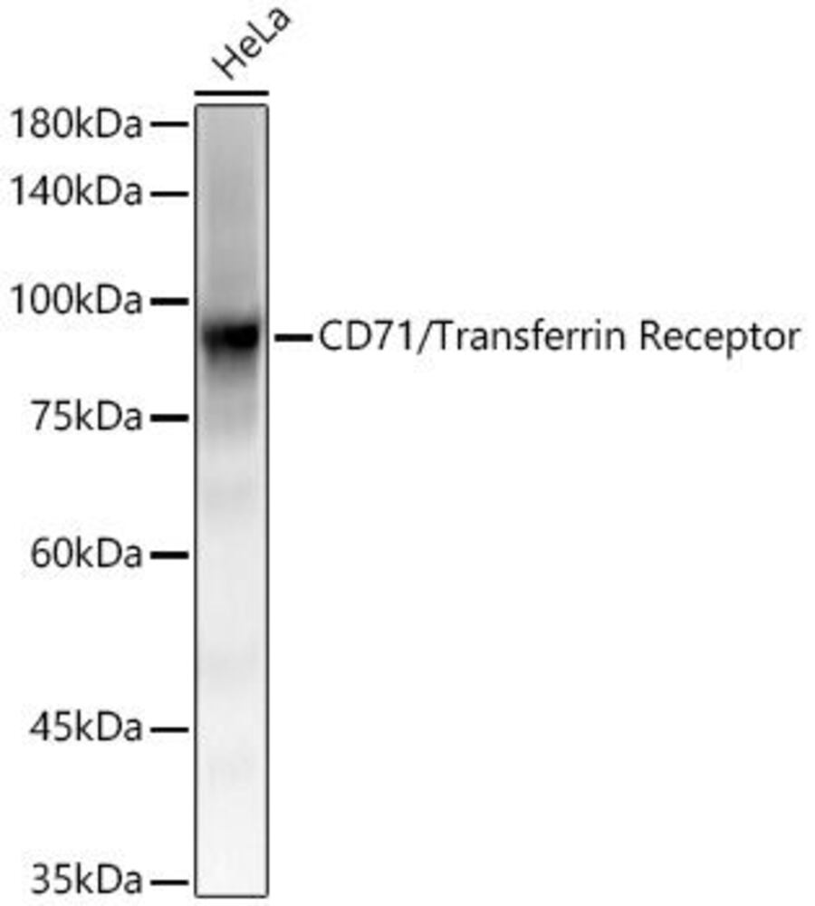 Anti-Transferrin Receptor Antibody [ARC5, 4396]