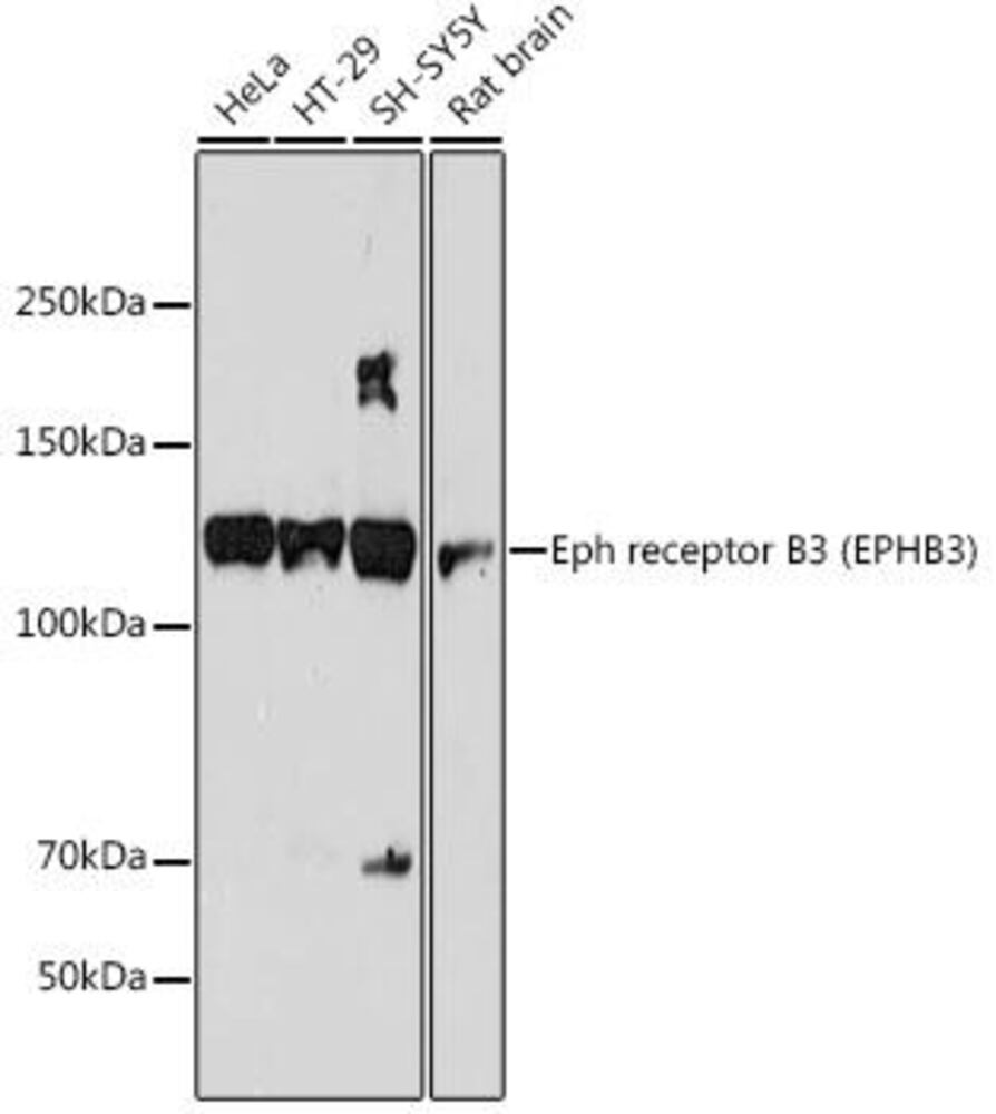 Anti-Eph receptor B3 Antibody [ARC2384]