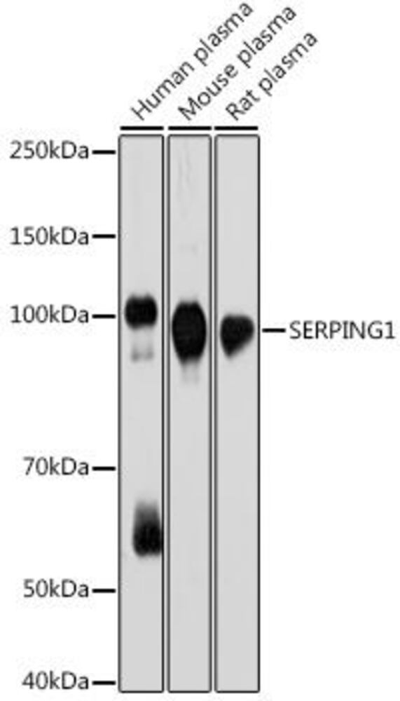 Anti-C1 inhibitor Antibody [ARC2427]