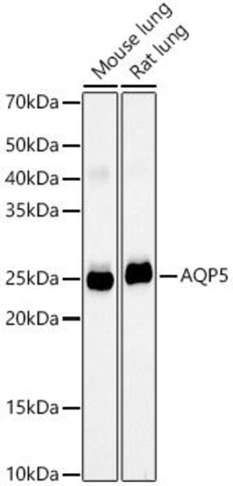 Anti-Aquaporin 5 Antibody [ARC59536]