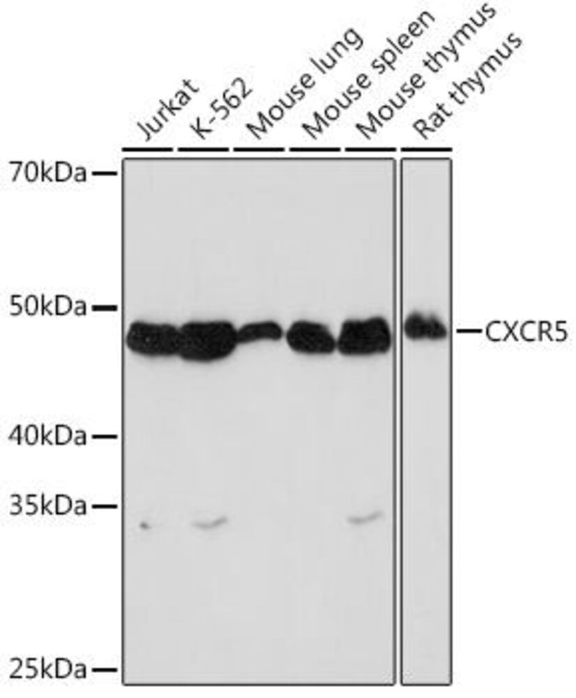 Anti-CXCR5 Antibody [ARC1363]