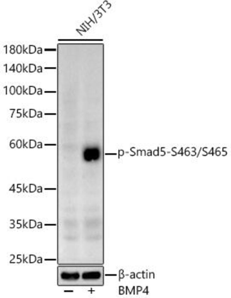 Anti-SMAD5 (phospho Ser463 + Ser465) antibody, 100 µl