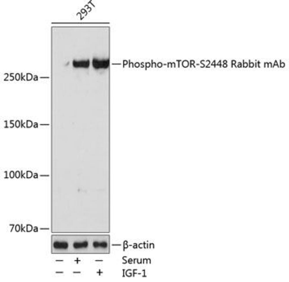 Anti-mTOR (phospho Ser2448) Antibody [AR, C0094]