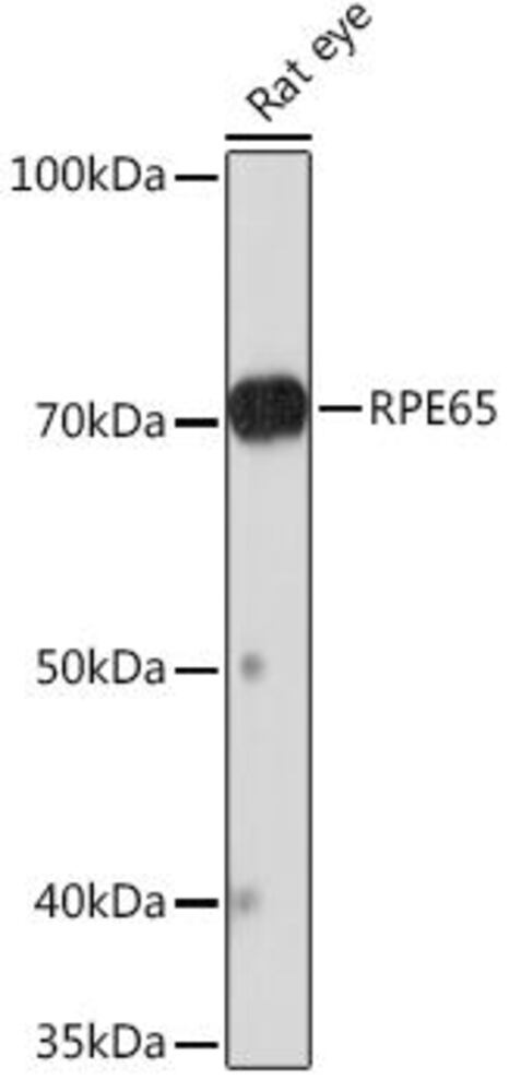 Anti-RPE65 Antibody [ARC1659]