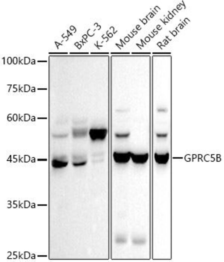 Anti-GPCR GPRC5B Antibody [ARC2932], 100 µl
