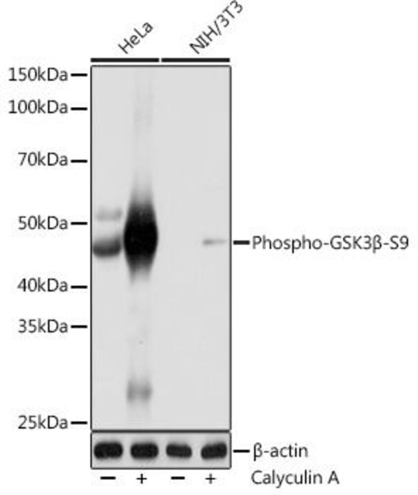 Anti-GSK3 beta (phospho Ser9) Antibody [ARC0069]
