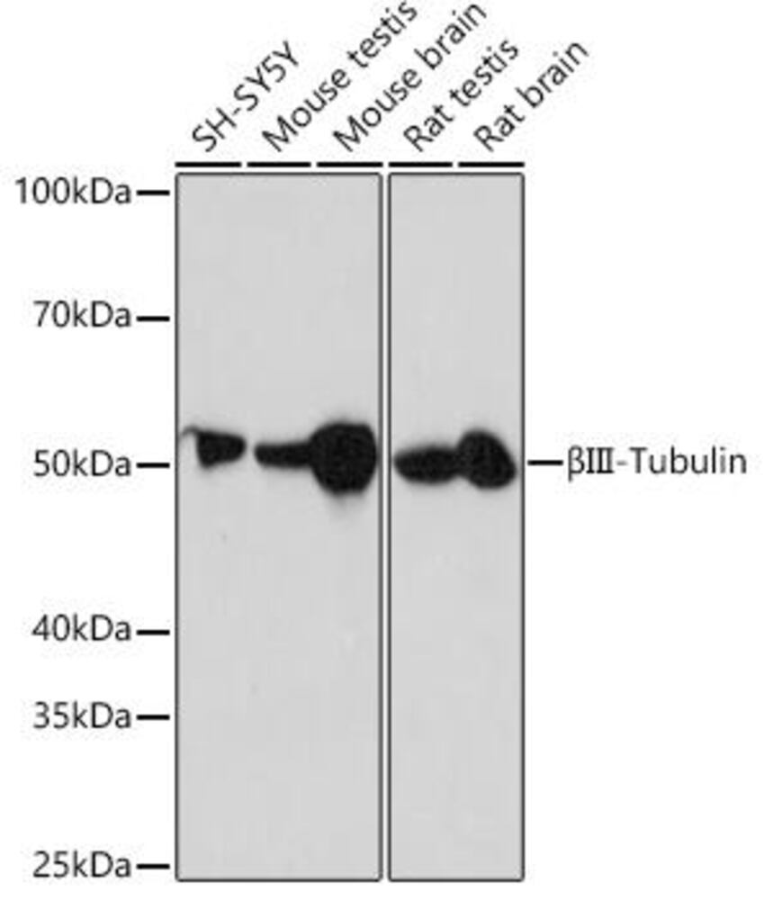 Anti-beta III Tubulin Antibody [ARC0456]
