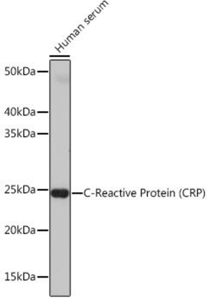 Anti-C Reactive Protein Antibody [ARC034, 1], 100 µl