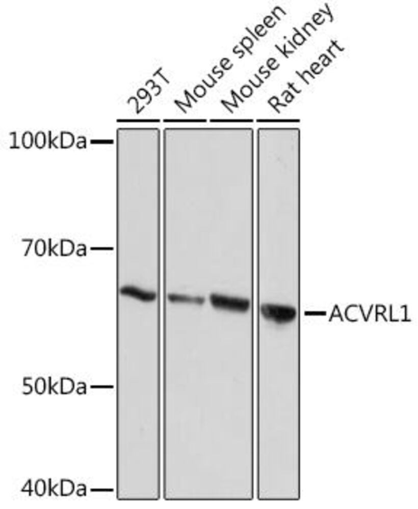 Anti-ALK-1 Antibody [ARC1735], 100 µl