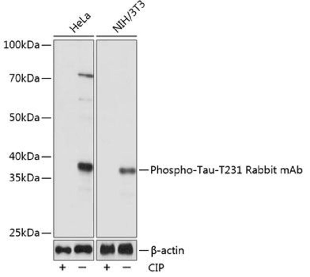 Anti-Tau (phospho Thr231) Antibody [ARC0, 021], 100 µl