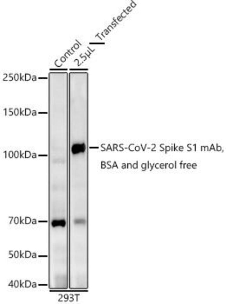Anti-SARS-CoV-2 Spike Glycoprotein S1 Antibody [ARC2373]